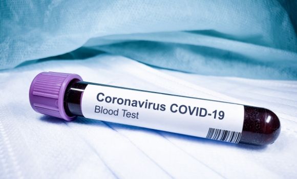 covid blood test